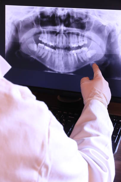 Best Emergency Care for Gum Disease in Una, WA