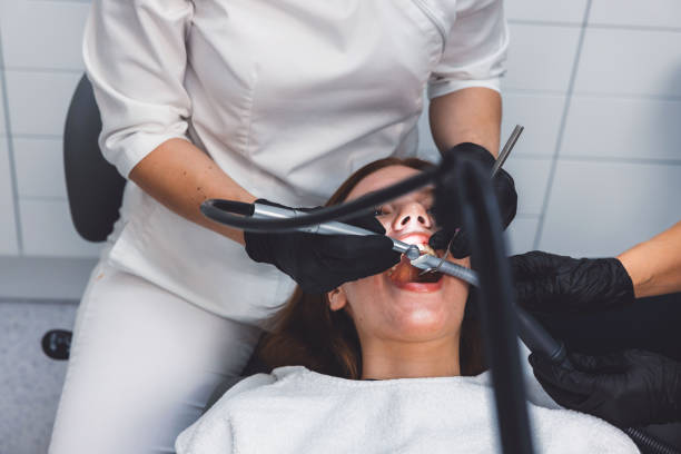 Best Emergency Wisdom Tooth Extraction in Una, WA